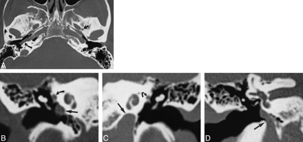 fig 1.