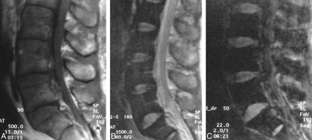 fig 2.