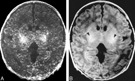 fig 5.