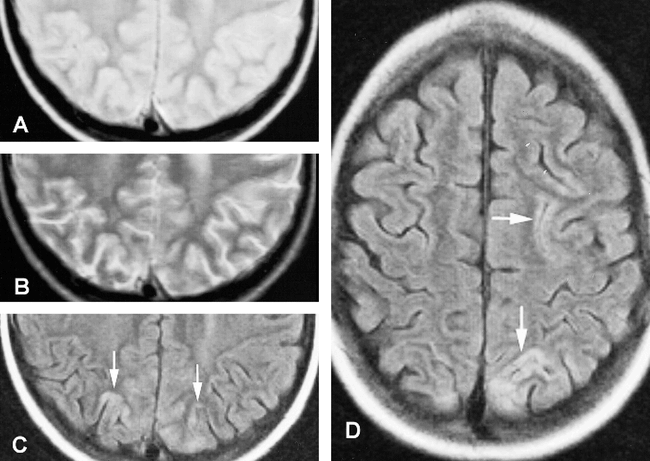 fig 3.
