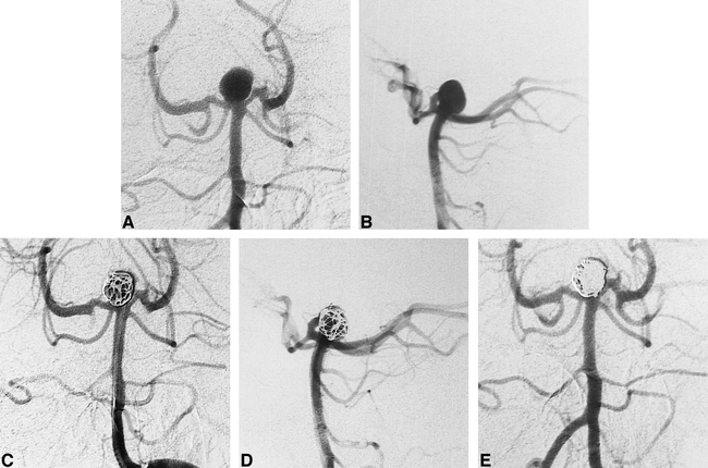 fig 2.