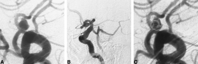 fig 3.