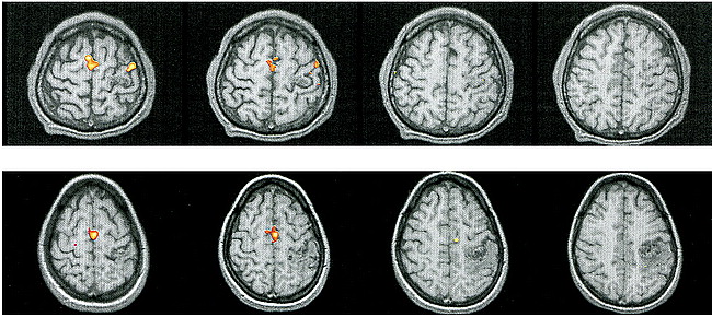 fig 4.
