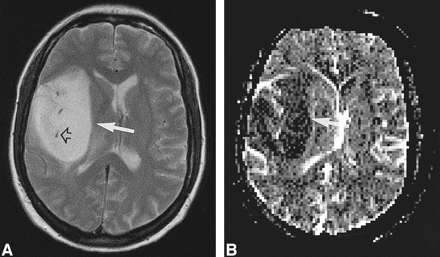 fig 4.