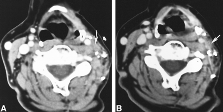 fig 3.