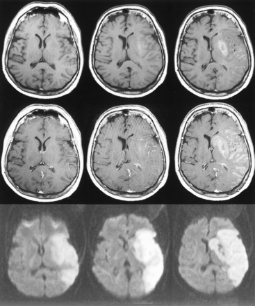 fig 2.