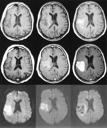 fig 3.