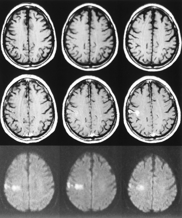 fig 4.