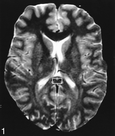 fig 1.