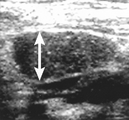 fig 2.