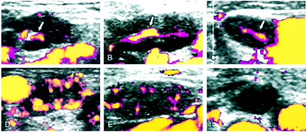 fig 3.