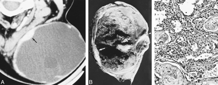 fig 2.