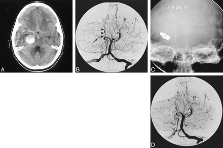 fig 2.