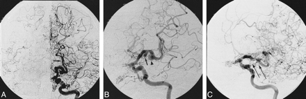 fig 6.