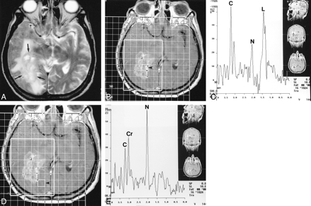 fig 1.