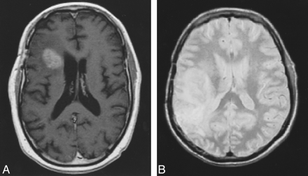 fig 1.