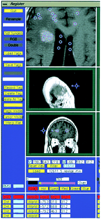 fig 2.