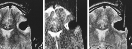 fig 4.
