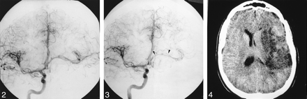 fig 2.