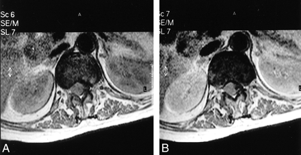 fig 4.