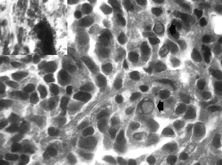 fig 6.
