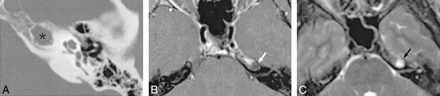 fig 3.