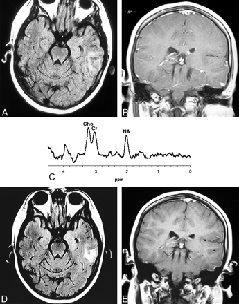 fig 3.