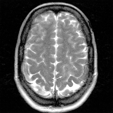 fig 1.