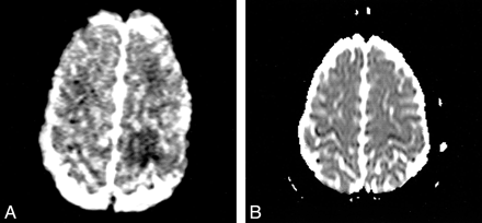 fig 4.