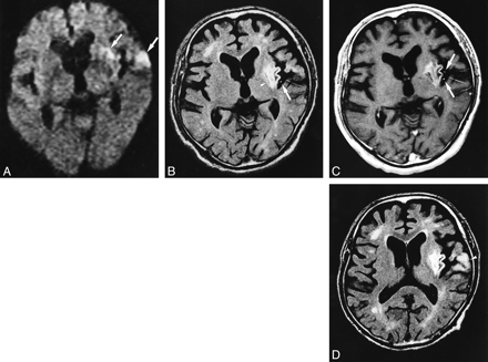 fig 1.