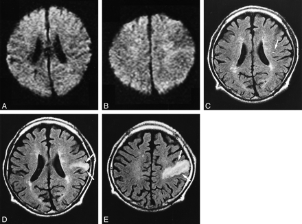 fig 2.