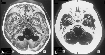fig 2.