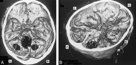 fig 7.