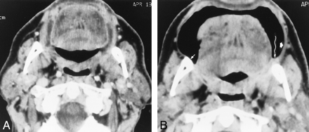 fig 3.