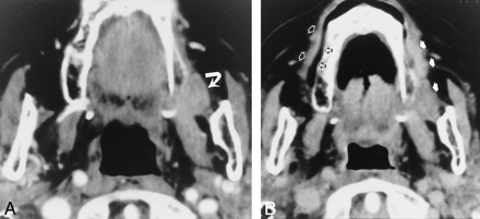 fig 4.