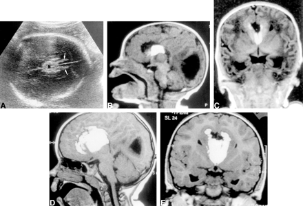 fig 1.