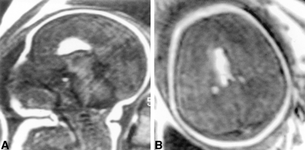 fig 2.