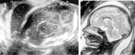 fig 3.