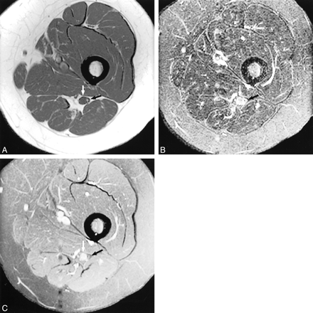 fig 5.