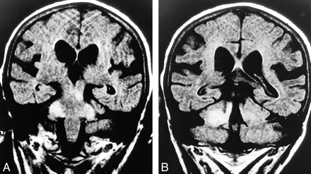 fig 5.