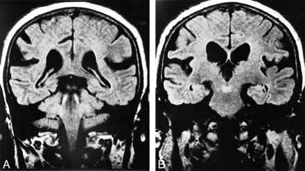fig 6.