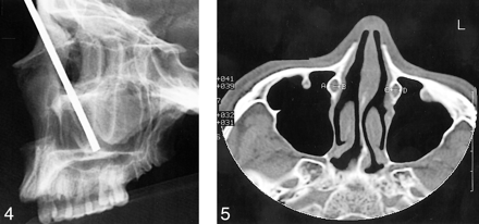 fig 4.