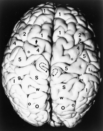 fig 1.