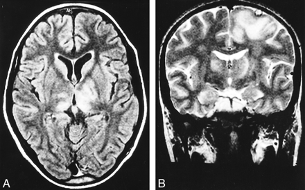 fig 1.