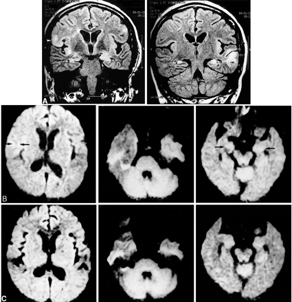 fig 5.