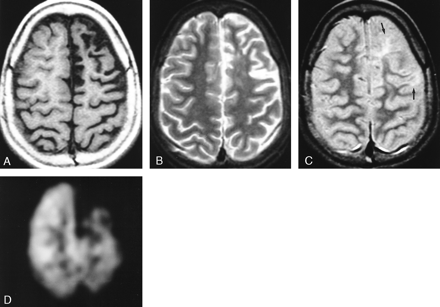 fig 2.