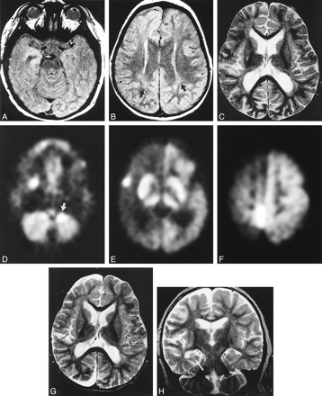 fig 3.