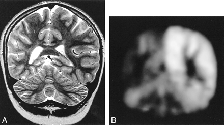 fig 4.
