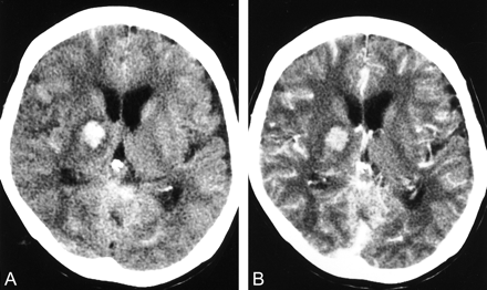 fig 2.