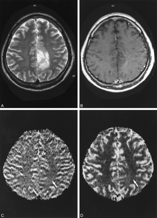 fig 2.